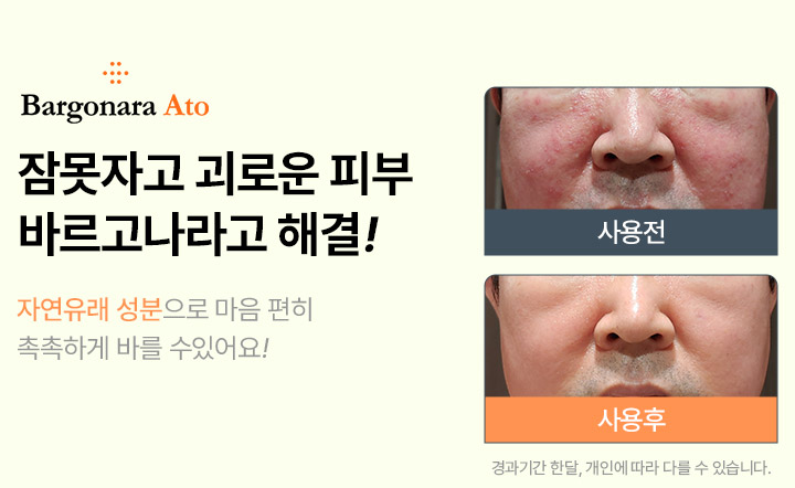 가려운피부 자연성분으로 보습케어