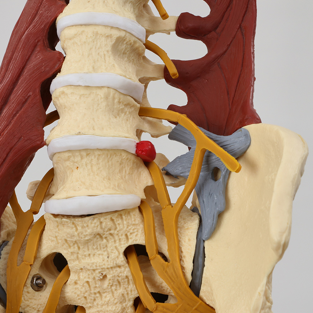 골반 모형 (주요근, 인대, 신경 부착)_3