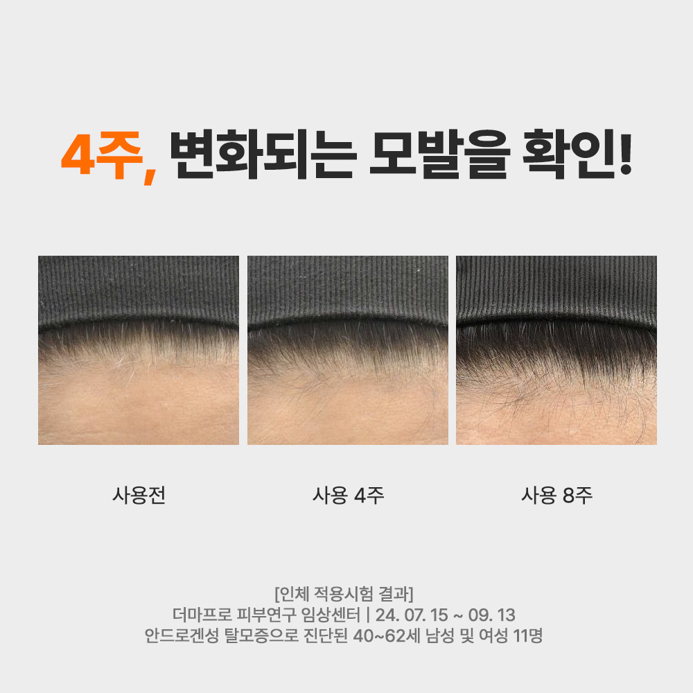 발모레아3.3 LNP 두피 세럼 10ml 3개_6