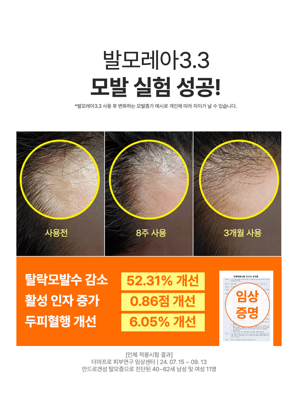 editor이미지