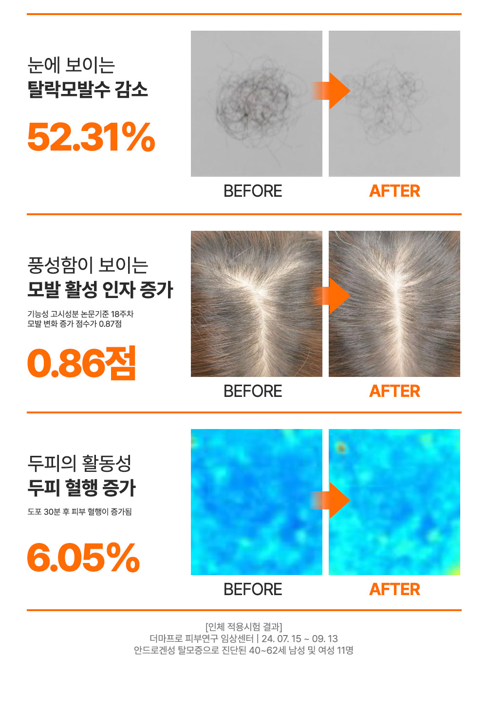 editor이미지
