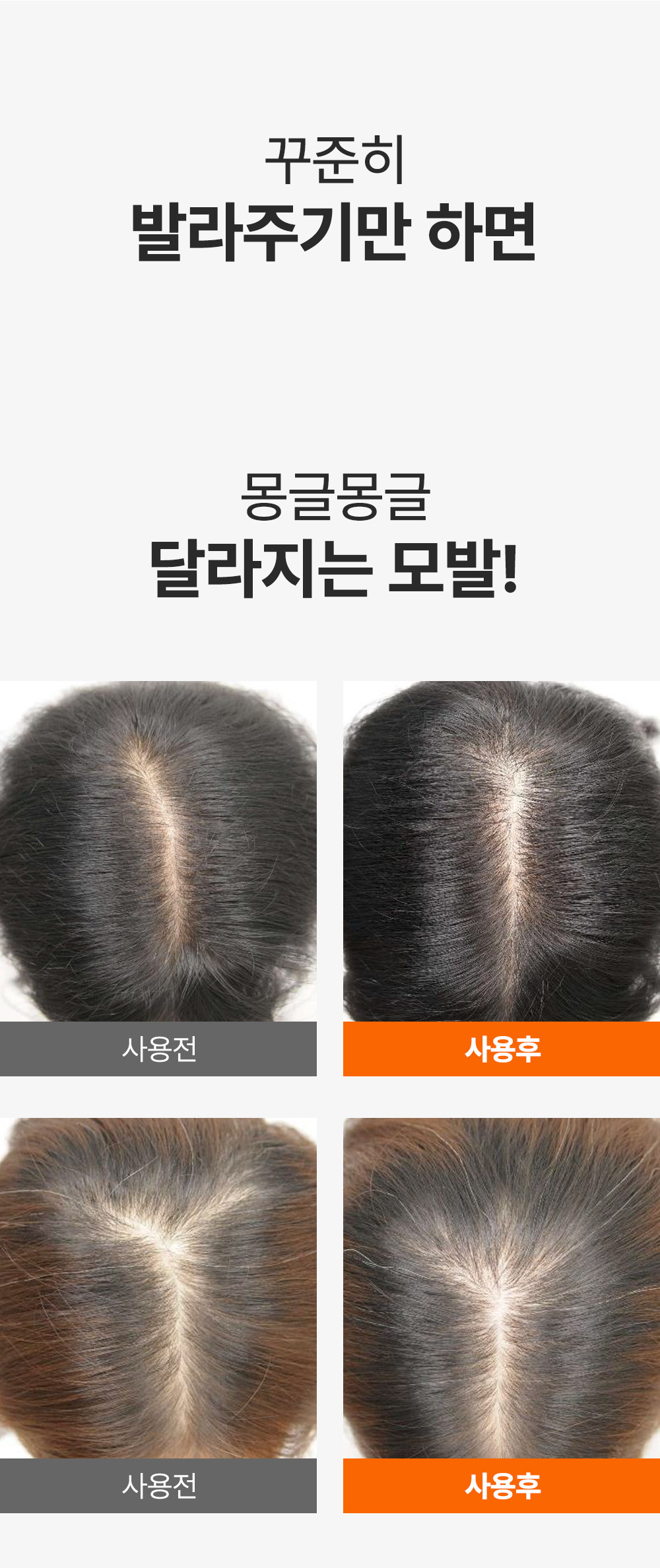 editor이미지