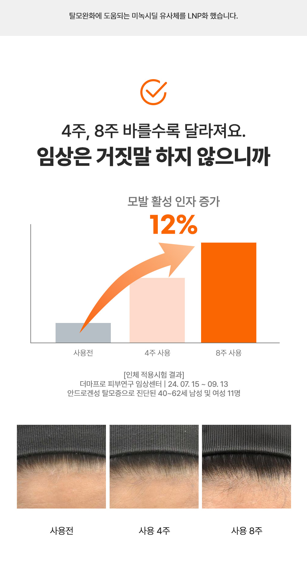 editor이미지