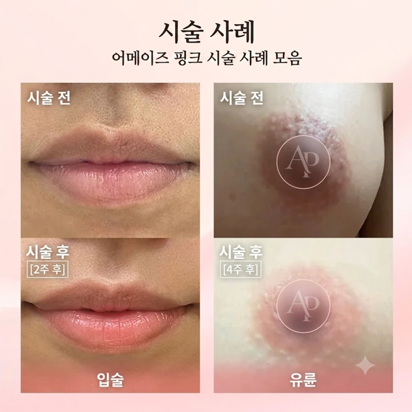 Thumbnails